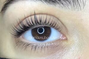 Ander&rsquo;s Beauty