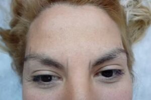 Centro de Depilacion Integral CECILIA