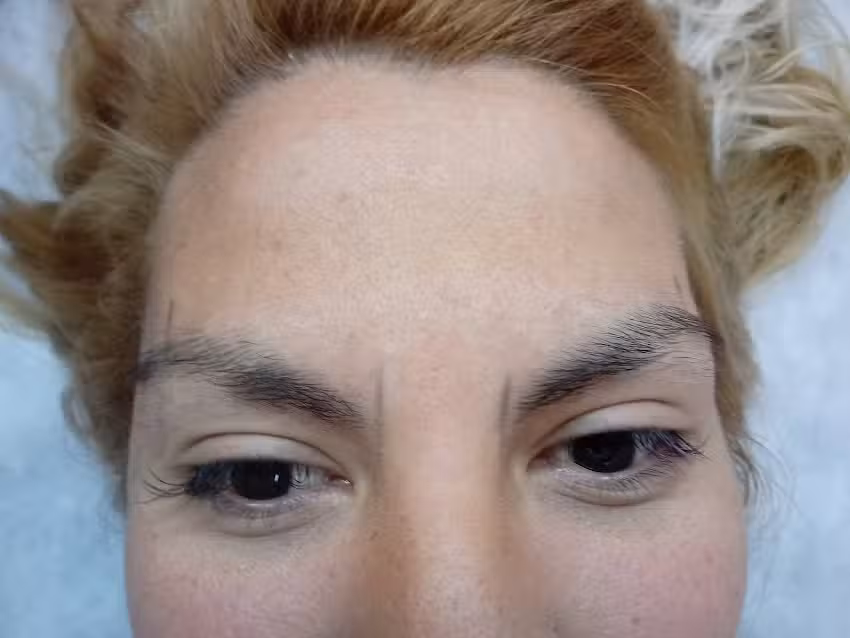 Centro de Depilacion Integral CECILIA