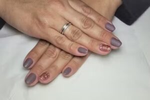 Centro de est&eacute;tica