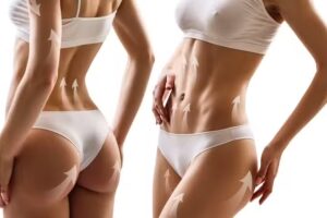 Depilike depilacion definitiva