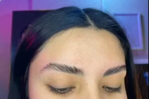 Est&eacute;tica ama tu piel