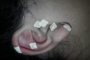 Estetica AMARTE corporal y facial