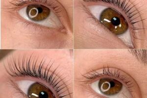 Est&eacute;tica Belu