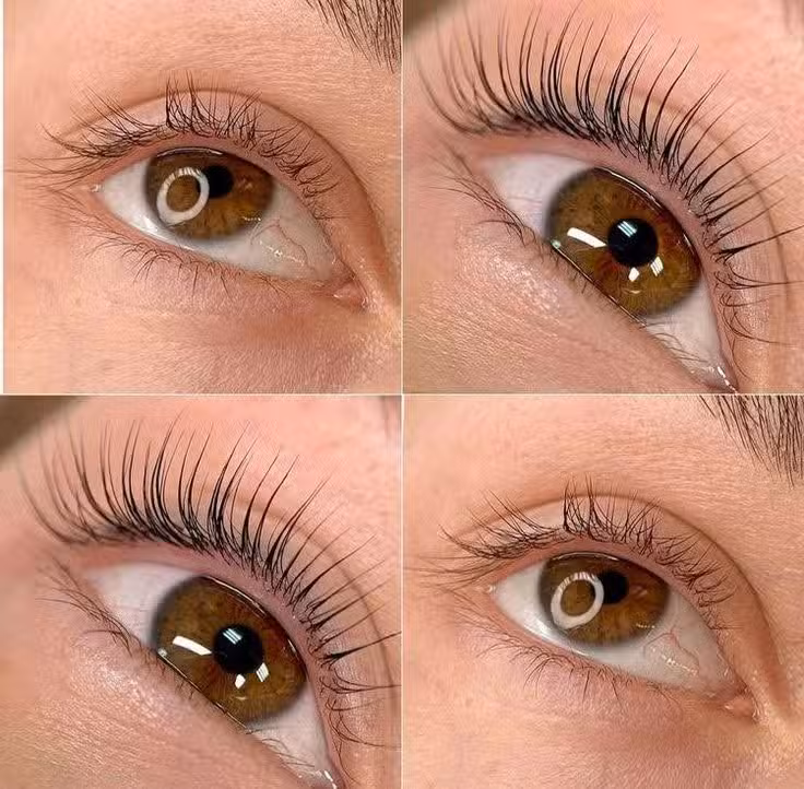 Est&eacute;tica Belu