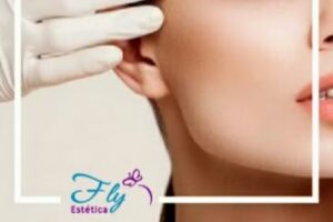 Fly Estética