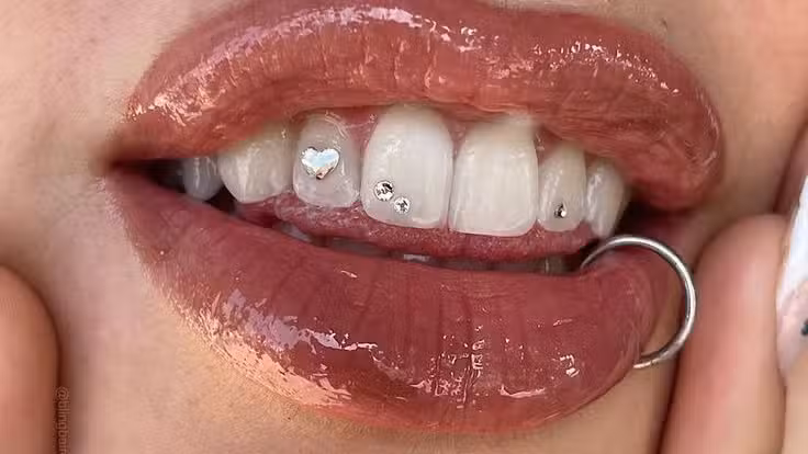 Gemas Dentales!💎 Zona sur