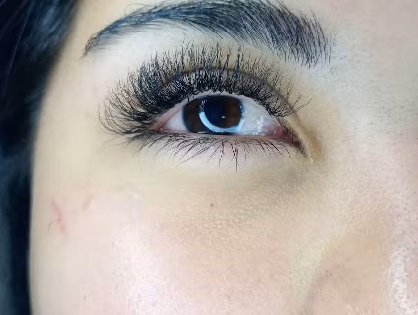 Mil destellos Estetica