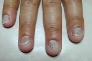 Pedicuria &ndash; Daniela R