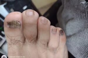 Podoest&eacute;tica MJ