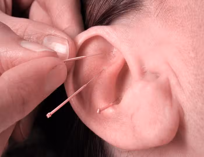 Qi-Xue Auriculoterapia Laferrere