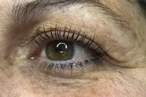 RUNA centro integral