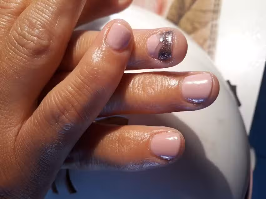 U&ntilde;as Viviana